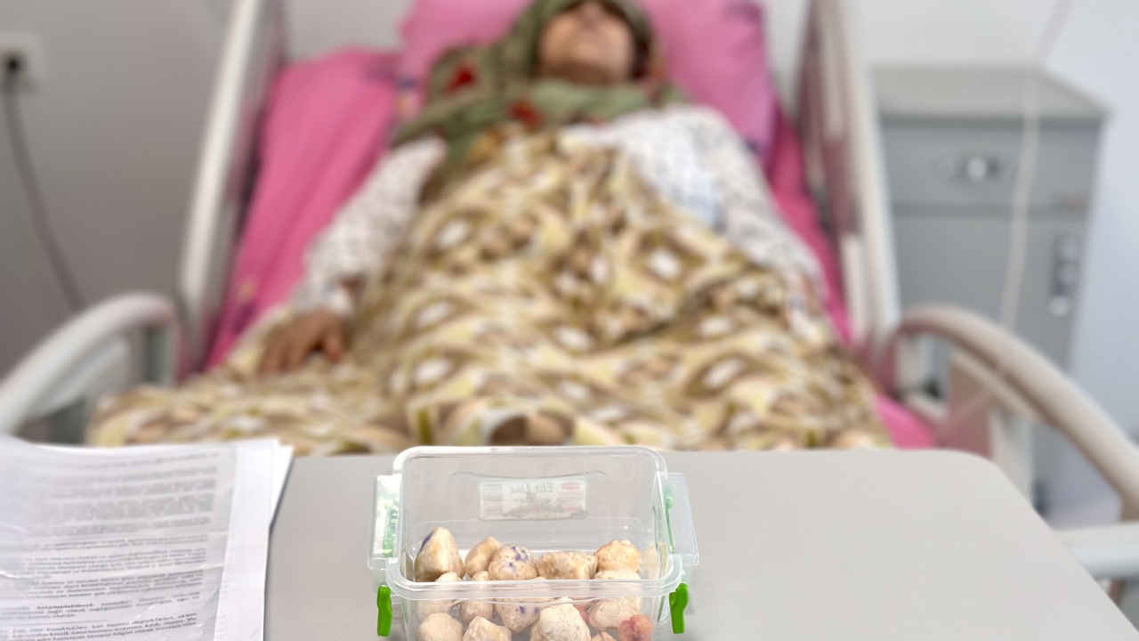 15 Yıl Diz Ağrısı Çekti, Dizinden 24 Taşlaşmış Tümör Çıktı