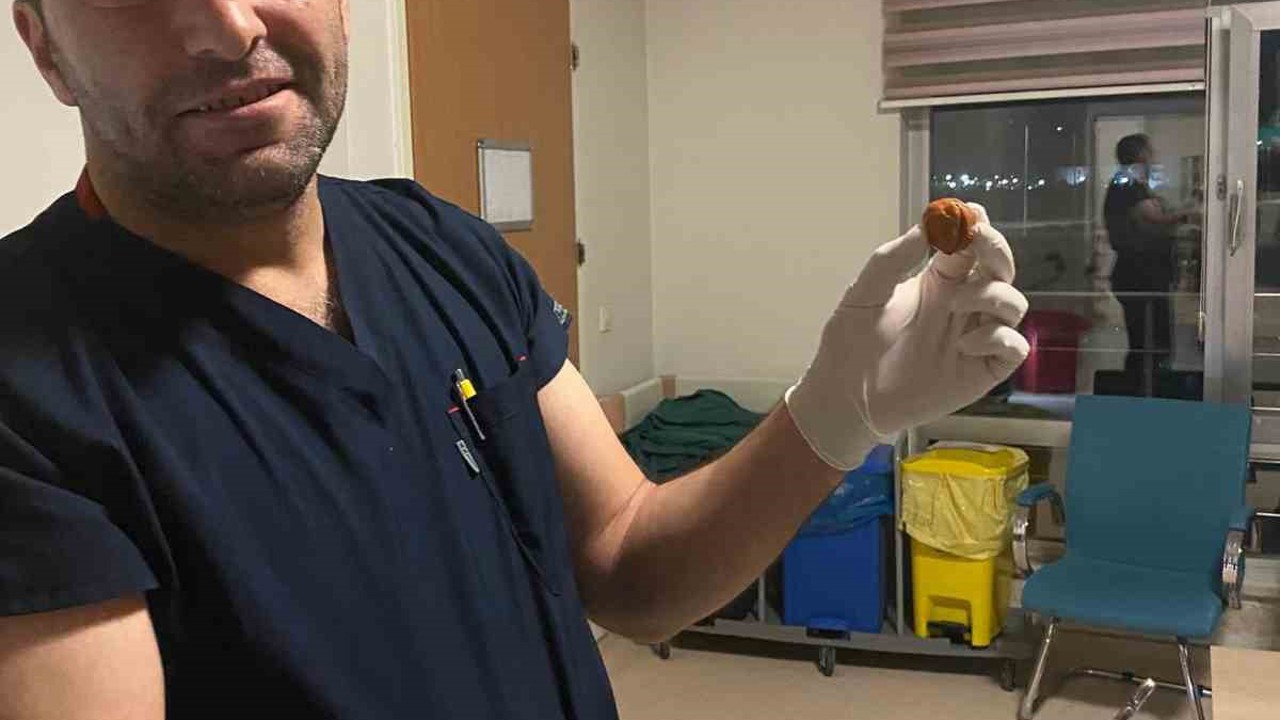 Ağrı’da yuttuğu ceviz yemek borusundan çıkarıldı
