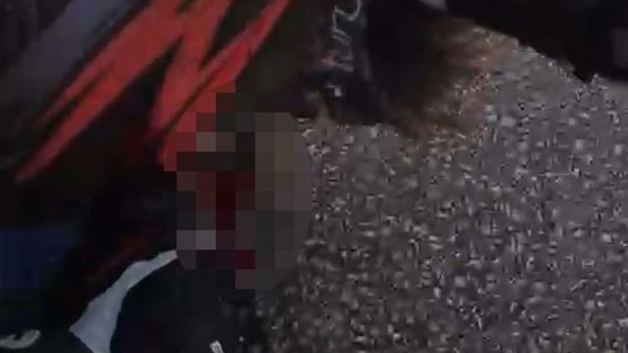 Motosikletiyle bariyere çarpmıştı, hayata 25 gün tutunabildi
