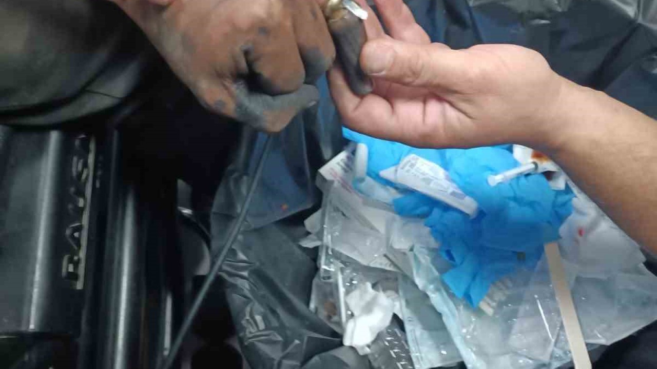 Parmakta sıkışan yüzük, hastanede doktor ve itfaiye ekibi tarafından çıkartıldı
