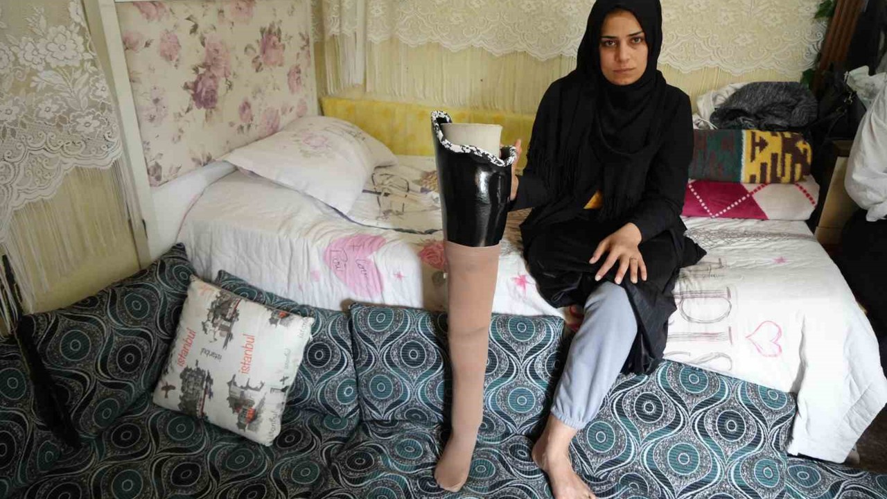 Kahramanmaraş merkezli büyük depremde bacağını kaybetti, eşi terk etti
