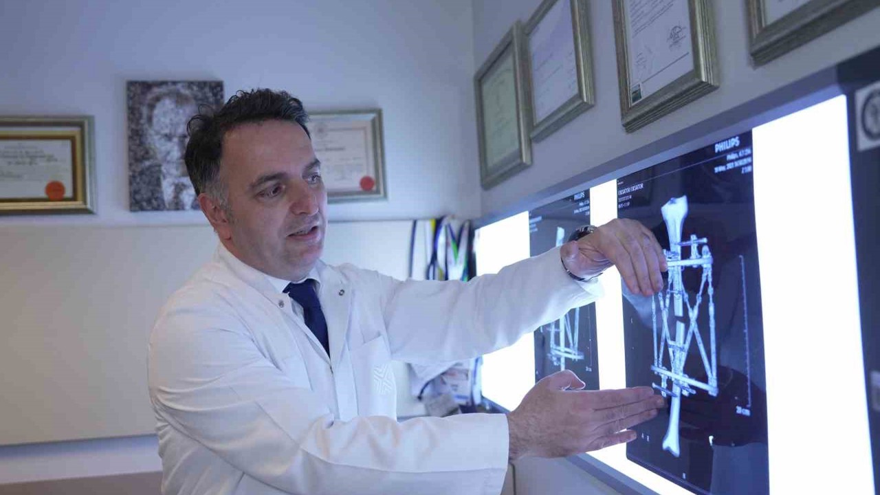 Boy kısalığına karşı modern çözüm: kemik uzatma yöntemleri
