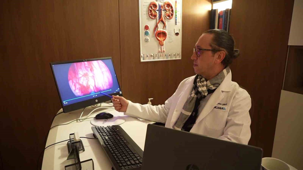 Prostata ’holep’ ile kesin çözüm: 400 grama kadar prostat güvenle alınabiliyor
