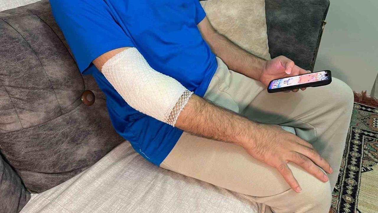 Başakşehir’de sitenin güvenlik görevlisine sahipli köpek saldırdı
