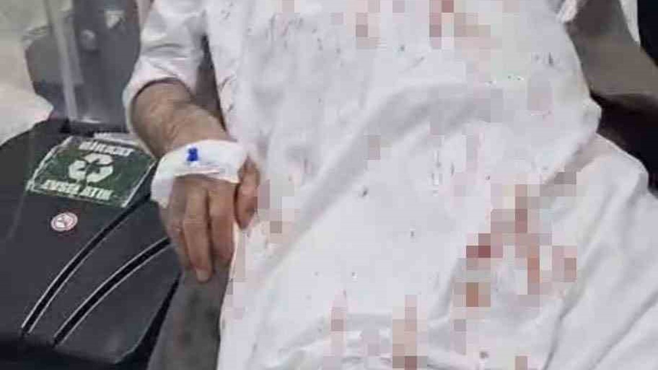 Şanlıurfa’da 72 yaşındaki adamı öldüresiye döven 4 şüpheli tutuklandı
