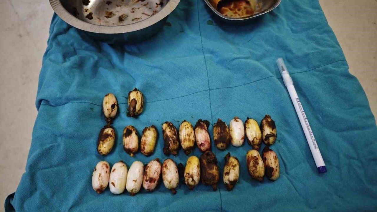 Midesinde taşıdığı uyuşturucu maddeler polisin dikkatinden sayesinde ele geçirildi
