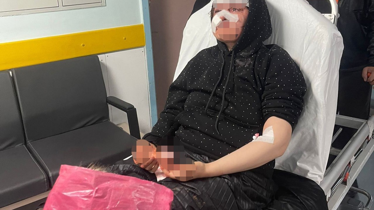 Boşanmak isteyen kadın eşi tarafından öldüresiye darp edildi
