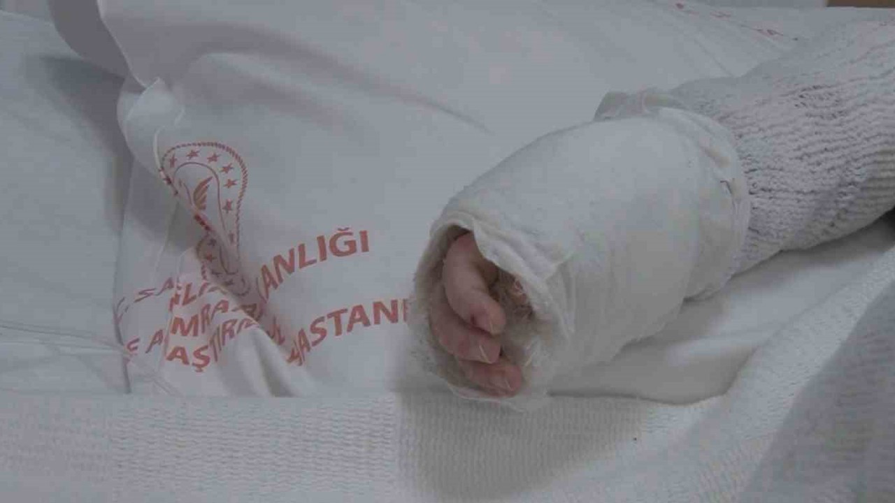 Üzerine kaynar su dökülen bebeğin vücudunun yüzde 27’si yandı
