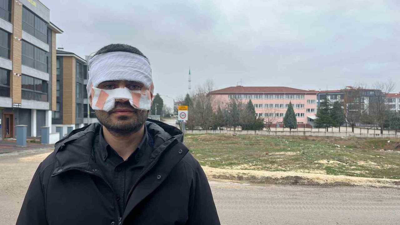 Rehber öğretmenin yüzüne sıcak çay fırlattığı fizik öğretmeni feci şekilde yandı
