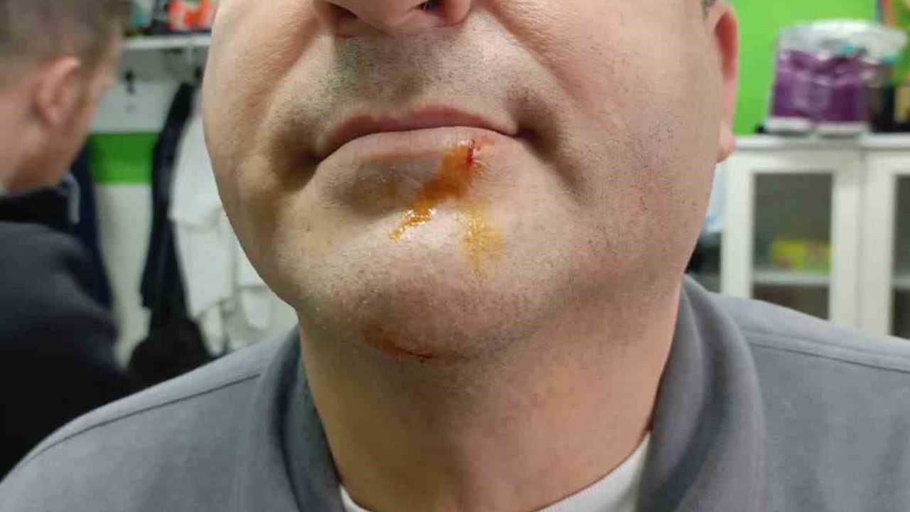 Zonguldak’ta 3. Lig maçı sonrası gerginlik: 2 gazeteci darbedildi, 2 polis yaralandı
