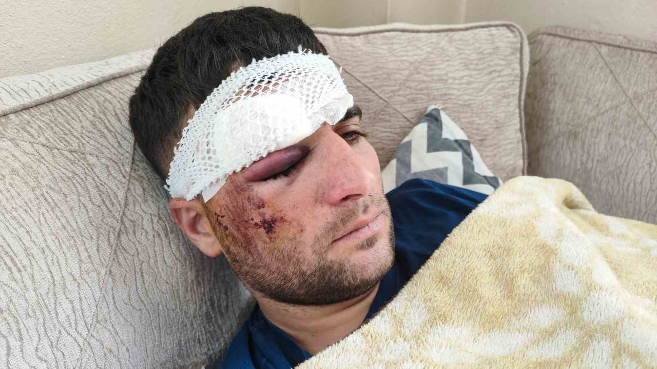 Döner ustası motosiklet sürücüsü: "Kaza sonrası kaçıp gittiler"
