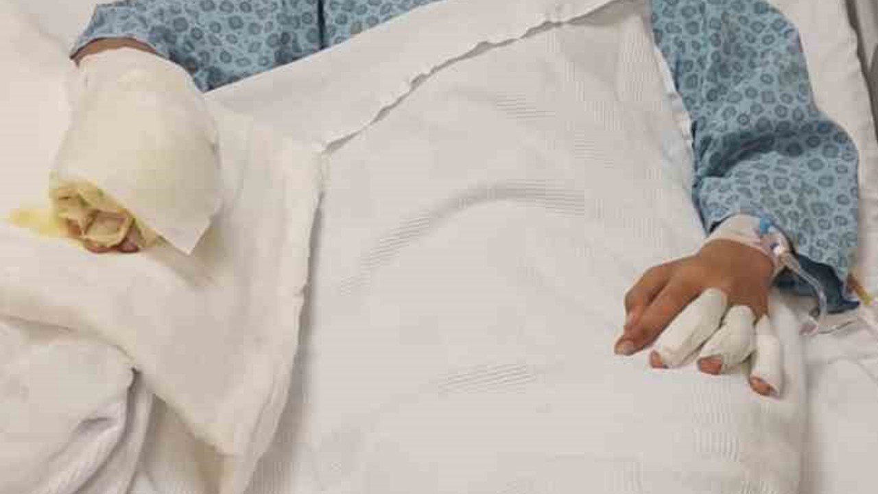 Ateşe benzin döktü, facianın eşiğinden döndü
