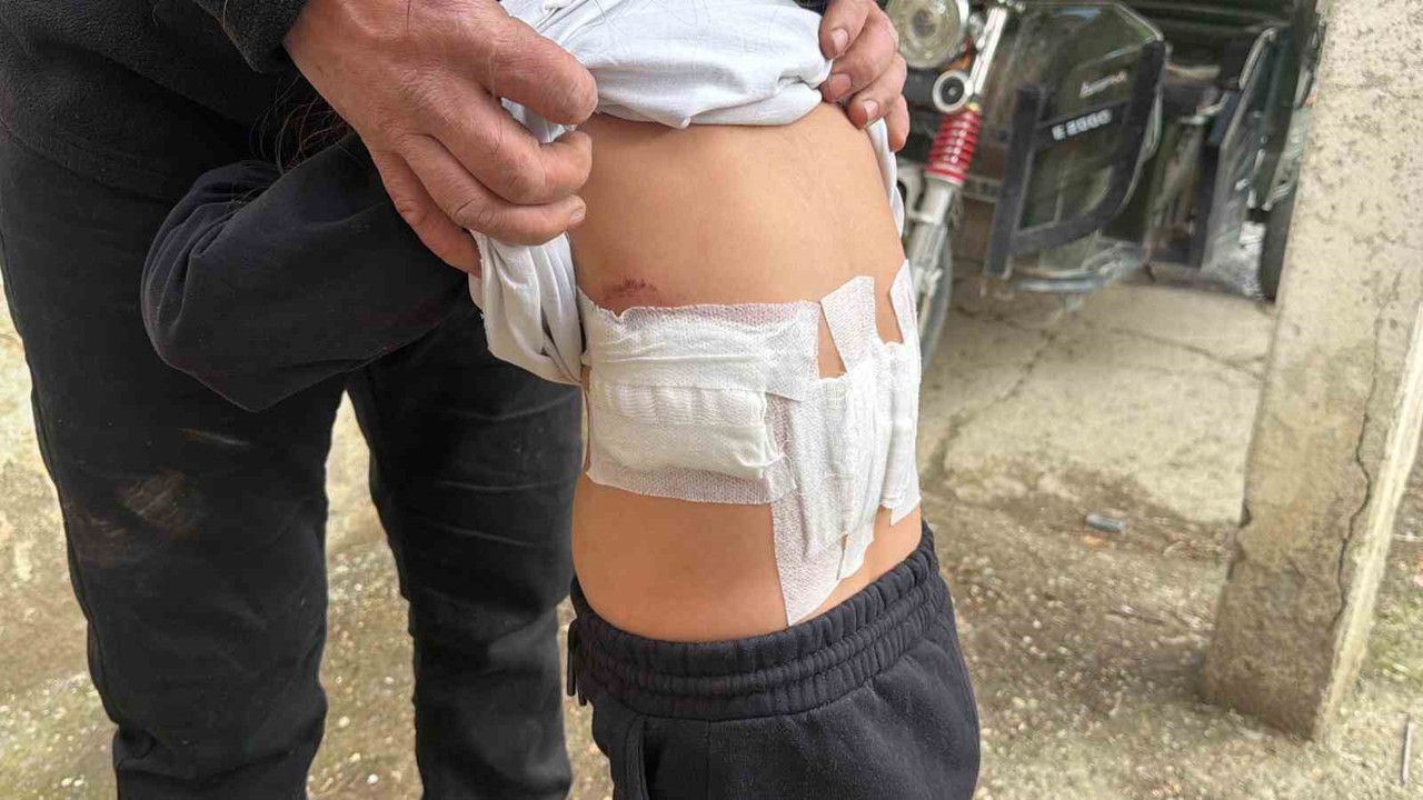 Saldırgan eşek evinin önünde oynayan 5 yaşındaki çocuğa kabusu yaşattı
