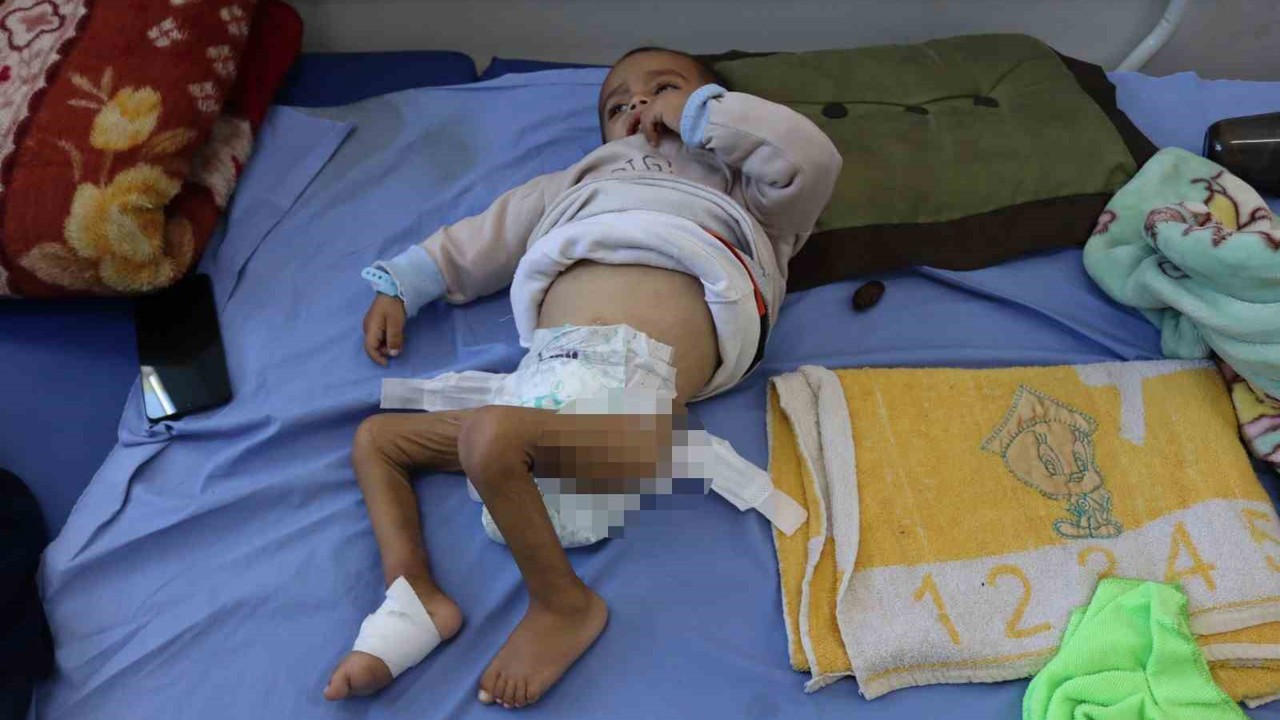 Gazzeli çocuklar ateşkesin gölgesinde açlıkla savaşıyor
