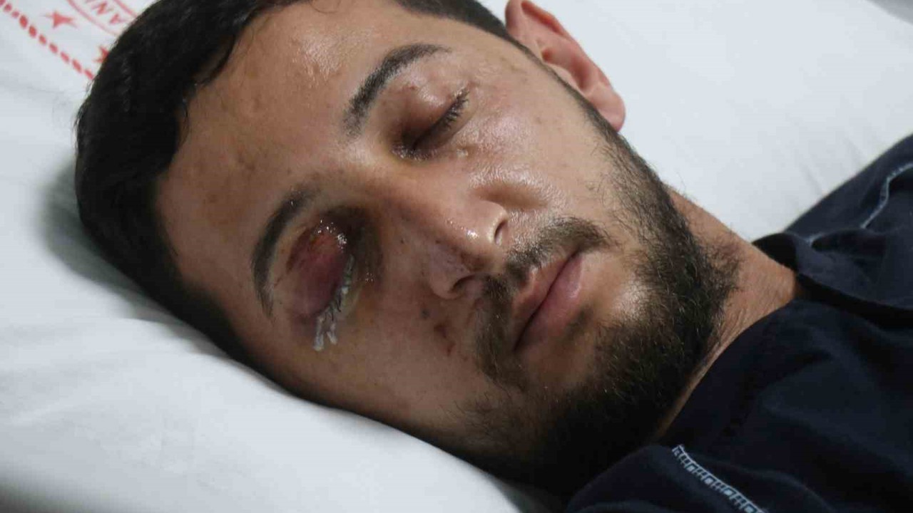 Düğün eğlencesi kabusa döndü: Sağ gözünden oldu
