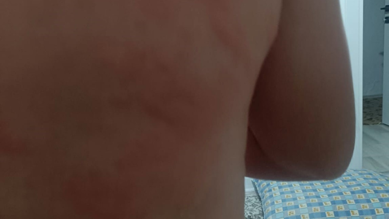 Elazığ’da böcek ısırığı hastanelik etti
