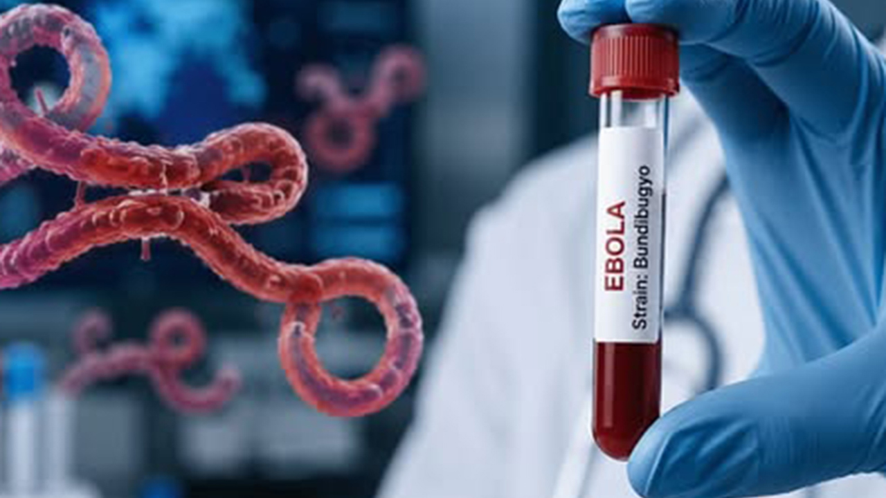 Ebola salgınına karşı acil önlem çağrısı: En ölümcül seviyeye ulaşmak üzere