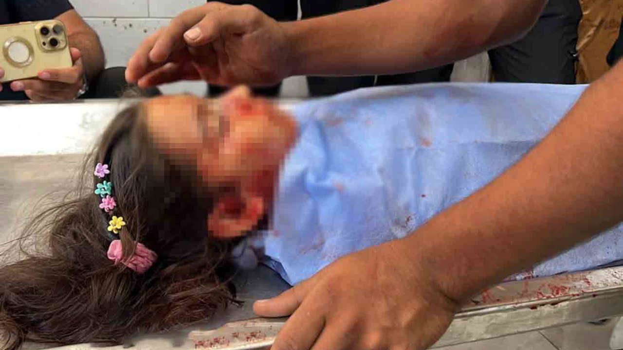 Gazze'de şehit sayısı 73 bin 39'a yükseldi