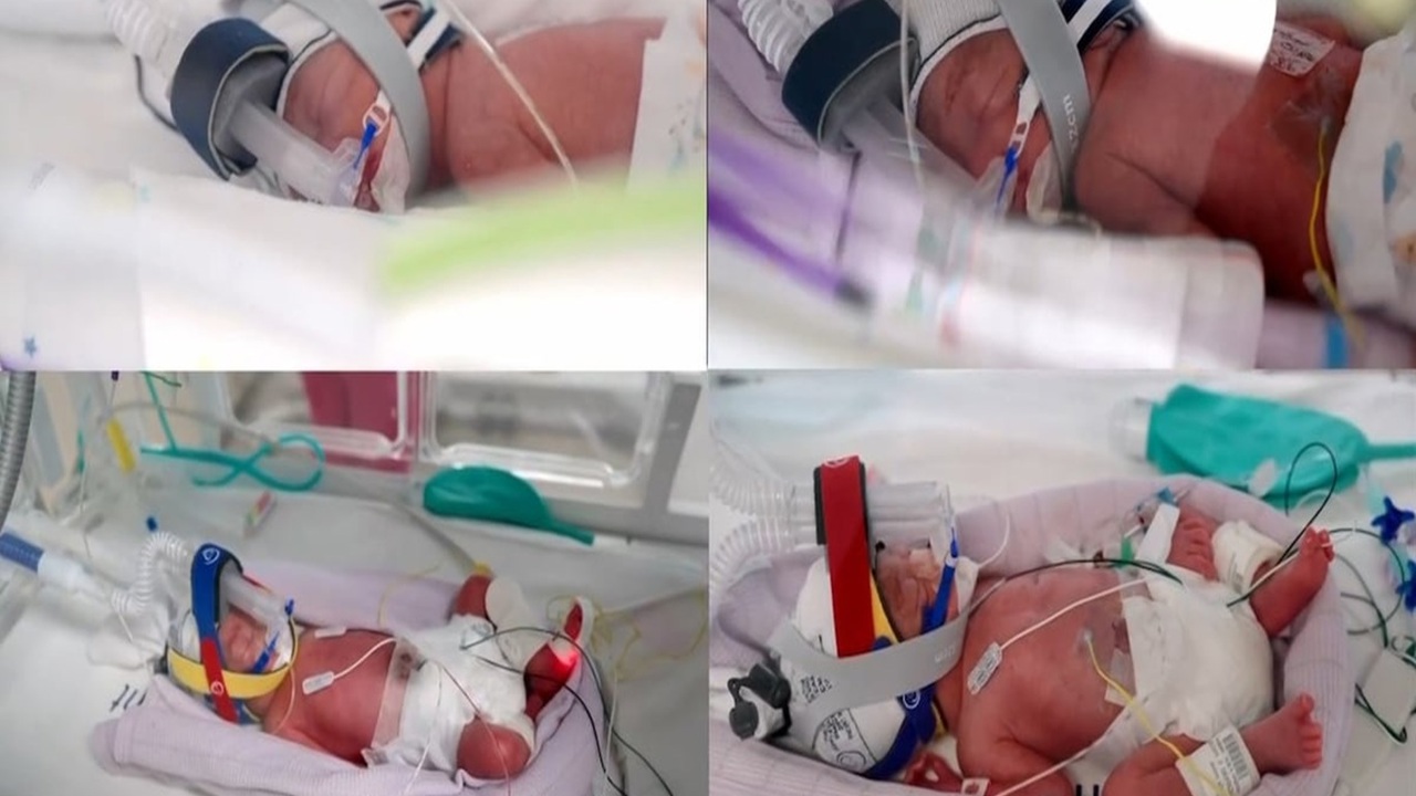 Avustralya’da tek yumurta dördüzleri dünyaya geldi 