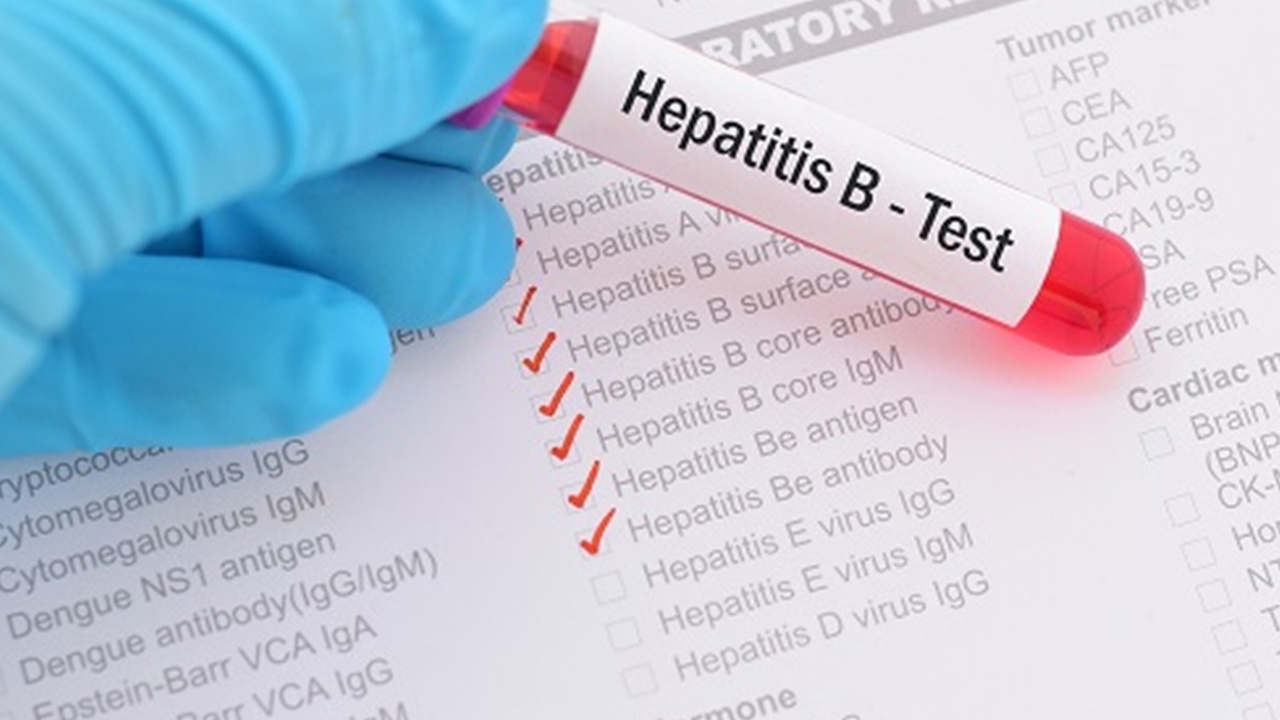 Hepatit B uyarısı: Sessiz ilerleyen hastalık siroza kadar gidebiliyor