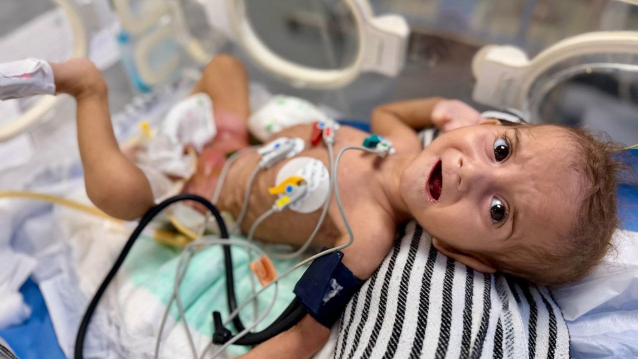 MSF: israilin kısıtlamaları nedeniyle Gazze'de hastaneler çalışamaz halde