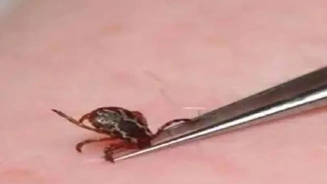 Sivas'ta vücuduna kene yapışan adam hayatını kaybetti
