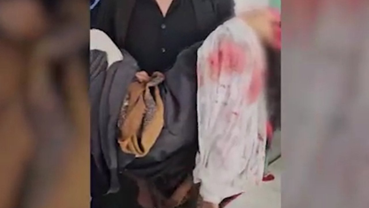 Suudi'nin Sana'ya saldırısında 2 sivil hayatını kaybetti