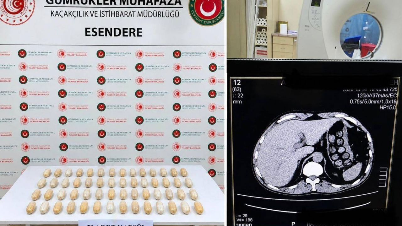Mide ve bağırsaklarında 58 kapsül uyuşturucu bulunan şüpheli tutuklandı