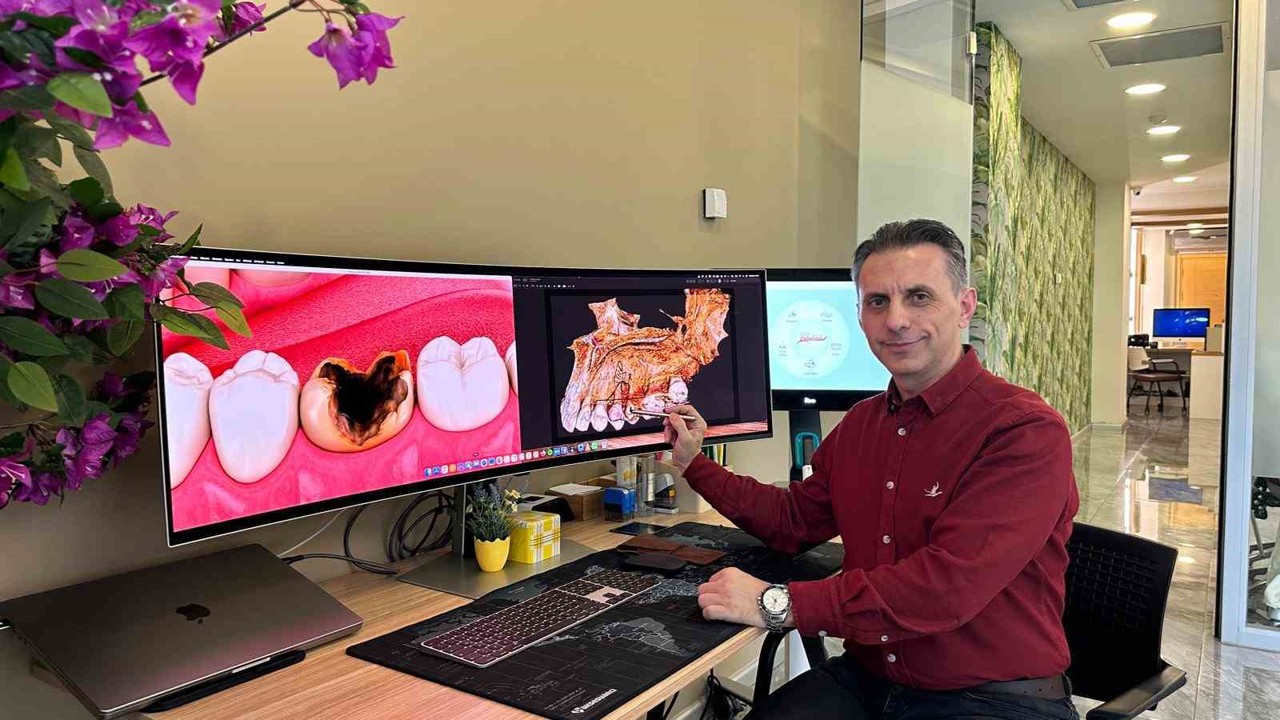 ’Diş ağrısı geçti’ diye sevinmeyin, belki de geç kaldınız
