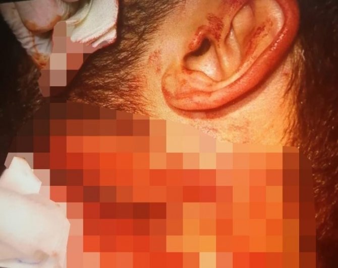 İzmir’de doktora jiletli saldırıyı yapan zanlı: "Dövmeye gittim"