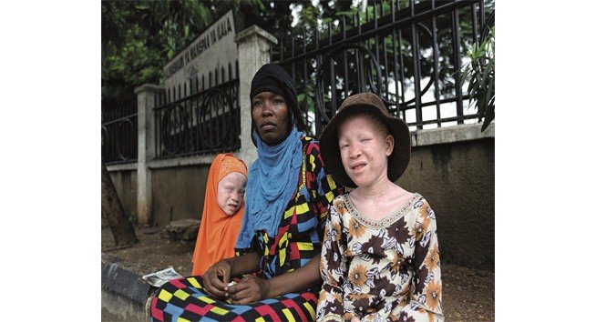 Afrikalı albinoların yaşamı İKÜSAG’da