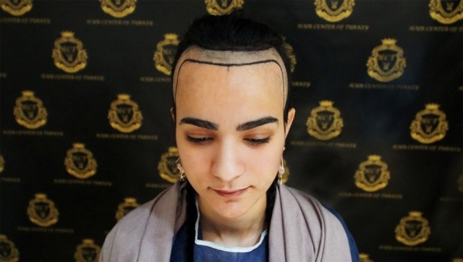 Hair Center of Turkey, kadınları saç dökülmesinde çözüme ulaştırıyor