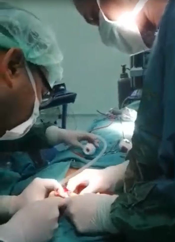 Nevşehir’de ilk kez ağız içinden guatr ameliyatı yapıldı